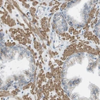Immunohistochemical staining of human prostate shows high expression.
