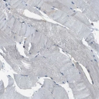 Immunohistochemical staining of human skeletal muscle shows low expression as expected.