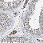 Anti-CLCN2 Antibody