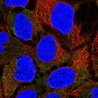 Immunofluorescent staining of human cell line CACO-2 shows localization to cytosol.