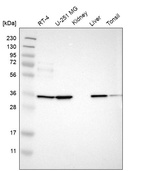 Anti-TMEM51 Antibody