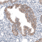 Anti-TMEM30A Antibody