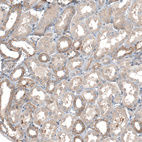 Immunohistochemical staining of human kidney shows moderate to strong membranous positivity in cells in tubules.