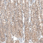 Immunohistochemical staining of human stomach shows moderate to strong membranous positivity in glandular cells.