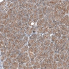 Immunohistochemical staining of human pancreas shows weak to moderate membranous positivity in exocrine glandular cells.