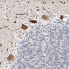 Anti-STARD9 Antibody