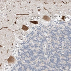 Anti-STARD9 Antibody