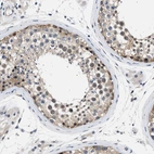 Immunohistochemical staining of human testis shows moderate cytoplasmic positivity in cells in seminiferous ducts.