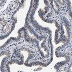 Immunohistochemical staining of human Fallopian tube shows weak cytoplasmic positivity in glandular cells.