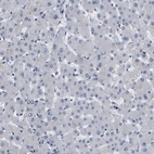 Immunohistochemical staining of human liver shows no positivity in hepatocytes as expected.