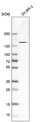 Western blot analysis in human cell line SK-BR-3.