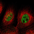 Immunofluorescent staining of human cell line A-431 shows localization to nucleoplasm.