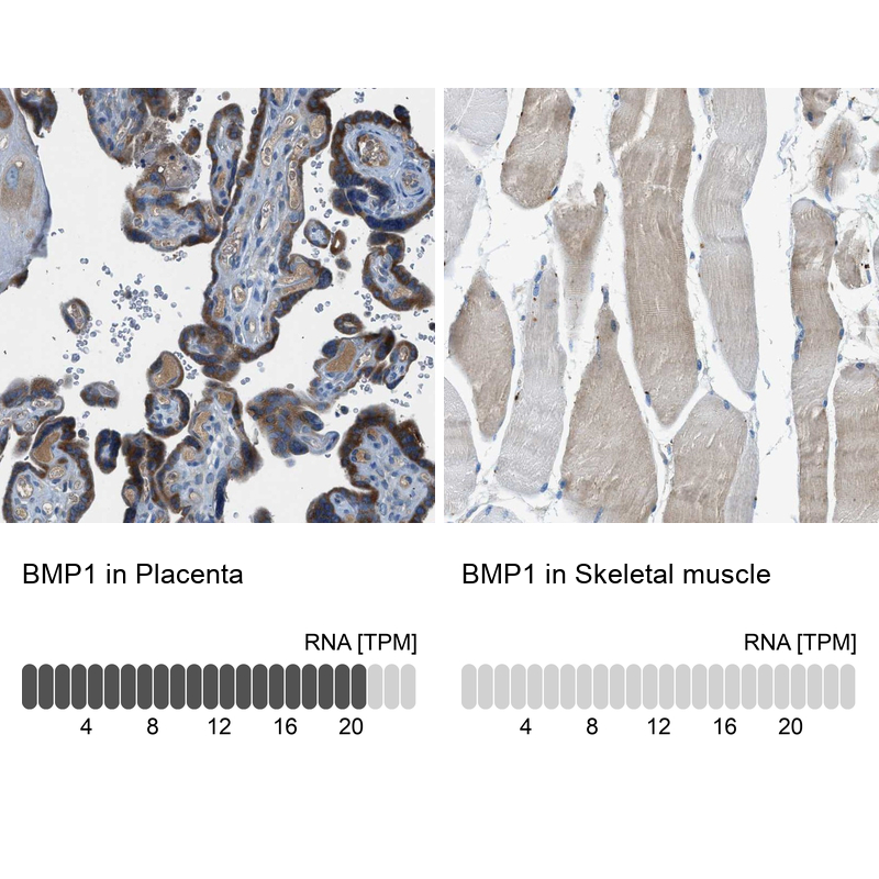 Anti-BMP1 Antibody