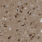Immunohistochemical staining of human Cerebral cortex shows strong granular cytoplasmic positivity in neuronal cells.