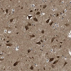 Immunohistochemical staining of human Cerebral cortex shows strong granular cytoplasmic positivity in neuronal cells.