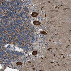 Immunohistochemical staining of human Cerebellum shows strong granular cytoplasmic positivity in Purkinje cells.
