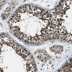 Immunohistochemical staining of human Testis shows moderate granular cytoplasmic positivity in cells in seminiferous ducts and Leydig cells.