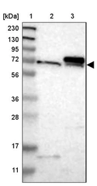 Lane 1: Marker [kDa] 230, 130, 95, 72, 56, 36, 28, 17, 11_br/_Lane 2: Human cell line RT-4_br/_Lane 3: Human cell line U-251MG sp