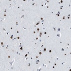 Anti-TMEM55A Antibody