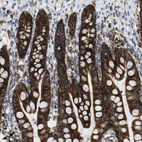 Immunohistochemical staining of human Small intestine shows strong membranous and granular cytoplasmic positivity in glandular cells.