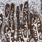 Immunohistochemical staining of human Small intestine shows strong membranous and granular cytoplasmic positivity in glandular cells.