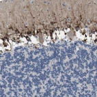 Immunohistochemical staining of human Cerebellum shows strong granular cytoplasmic positivity in cells in molecular layer.