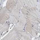 Immunohistochemical staining of human Skeletal muscle shows very weak cytoplasmic positivity in myocytes.