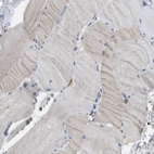 Immunohistochemical staining of human Skeletal muscle shows very weak cytoplasmic positivity in myocytes.