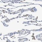 Immunohistochemical staining of human lung shows weak cytoplasmic positivity in macrophages.
