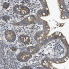 Immunohistochemical staining of human small intestine shows moderate granular cytoplasmic positivity in glandular cells.