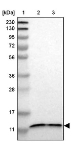 Lane 1: Marker [kDa] 230, 130, 95, 72, 56, 36, 28, 17, 11_br/_Lane 2: Human cell line RT-4_br/_Lane 3: Human cell line U-251MG sp