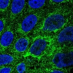 Immunofluorescent staining of human cell line CACO-2 shows localization to mitochondria.