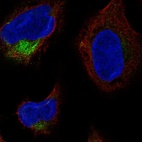 Immunofluorescent staining of human cell line U-2 OS shows localization to endoplasmic reticulum.