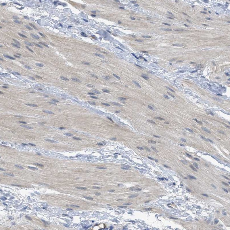 Anti-TNFAIP1 Antibody