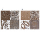 Anti-ARHGEF11 Antibody