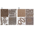 Anti-ARHGEF11 Antibody