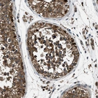 Immunohistochemical staining of human testis shows strong cytoplasmic positivity in cells in seminiferous ducts.