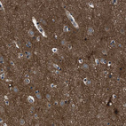 Immunohistochemical staining of human cerebral cortex shows moderate cytoplasmic positivity in neurons.