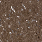 Immunohistochemical staining of human cerebral cortex shows moderate cytoplasmic positivity in neurons.