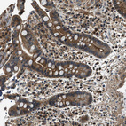 Immunohistochemical staining of human colon shows moderate cytoplasmic positivity in glandular cells.