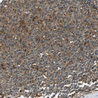 Immunohistochemical staining of human tonsil shows moderate cytoplasmic positivity in germinal center cells.