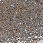 Immunohistochemical staining of human tonsil shows moderate cytoplasmic positivity in germinal center cells.