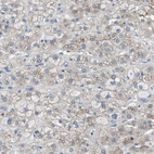 Anti-UAP1 Antibody