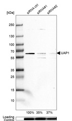 Western blot analysis in A-431 cells transfected with control siRNA, target specific siRNA probe #1 and #2, using Anti-UAP1 antibody. Remaining relative intensity is presented. Loading control: Anti-GAPDH.