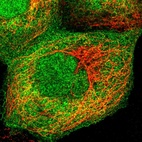 Immunofluorescent staining of human cell line A-431 shows localization to nucleoplasm, plasma membrane & cytosol.