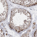 Immunohistochemical staining of human testis shows strong granular positivity in cytoplasm in a subset of cells in seminiferous ducts.