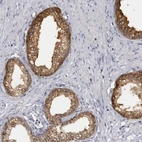 Immunohistochemical staining of human prostate shows strong granular positivity in cytoplasm in glandular cells.