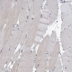 Immunohistochemical staining of human skeletal muscle shows no positivity in myocytes as expected.