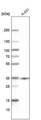 Anti-SLC25A22 Antibody
