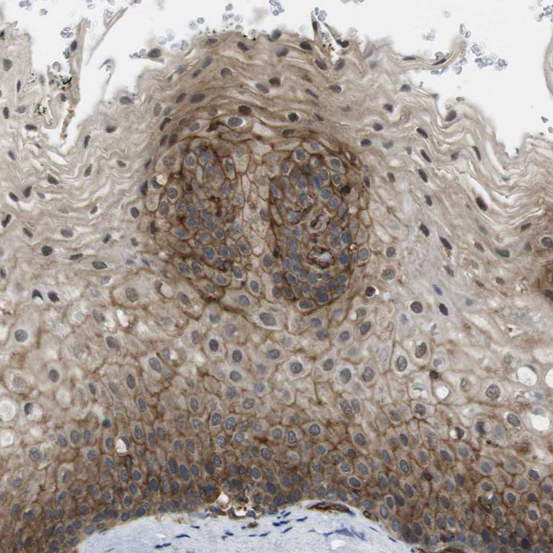 Anti-ZDHHC5 Antibody